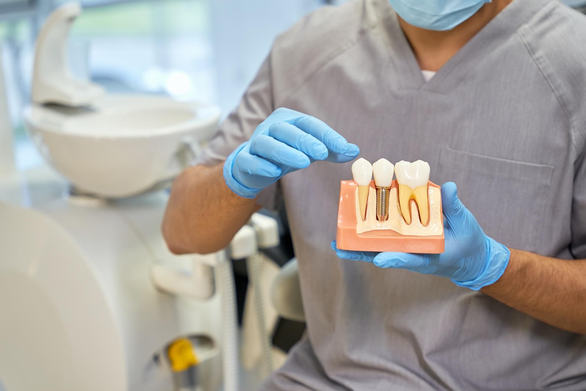 tecnologia-vanguardia-implantes