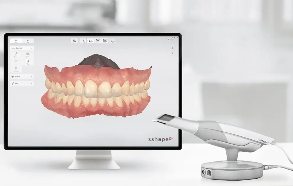 escaner dental